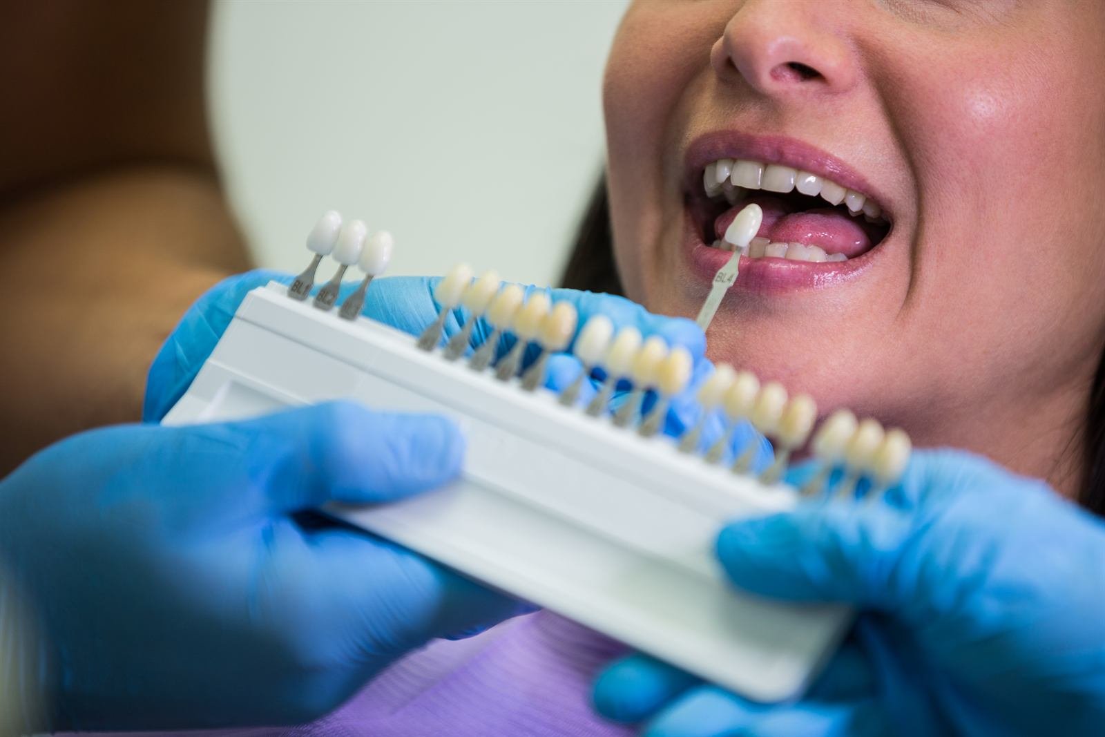 Muestrario de tonos de dientes para coronas y prótesis dentales